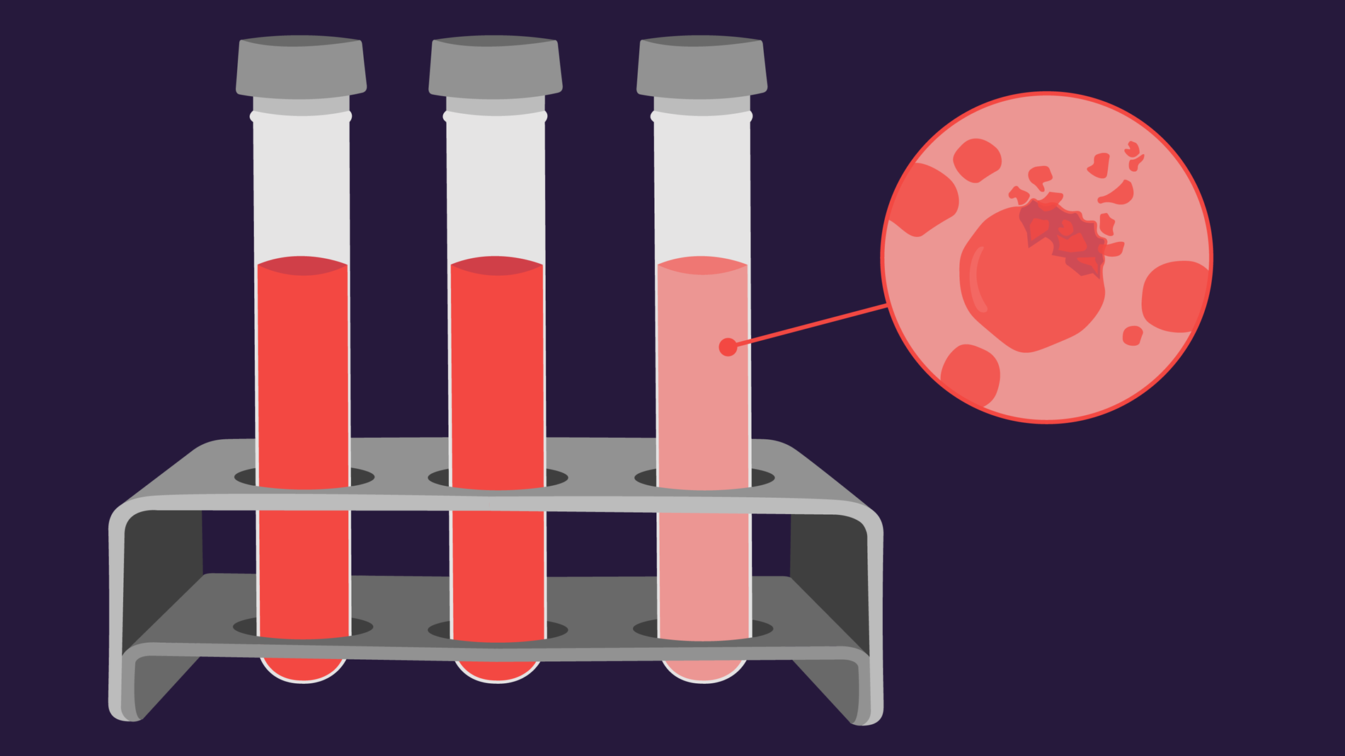 Illustration of hemolysis - Vials with blood sample